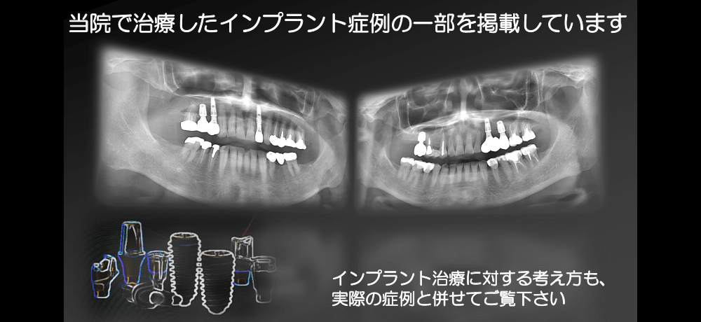 スライド画像